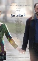 The Attack